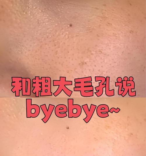 脸上的毛孔粗大是什么原因造成的？如何有效缩小毛孔？